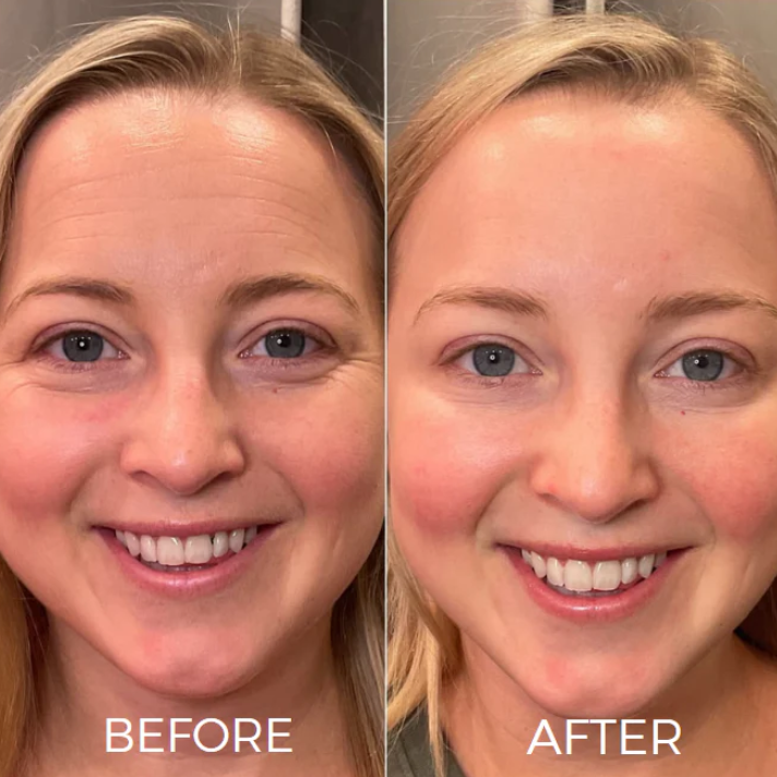 BOOST SERUM™ 5-1 ANTI AGE SERUM