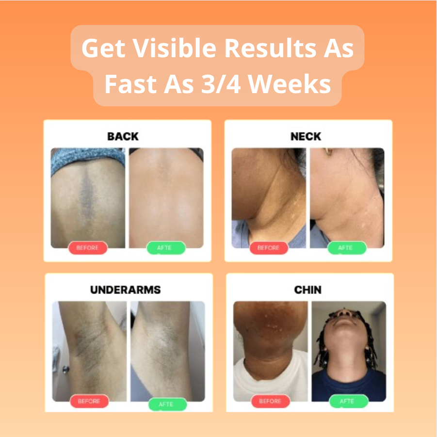 GEVONA ™ Turmeric & Kojic Acid Cleansing Pads 30 ct