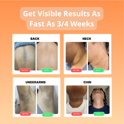 GEVONA ™ Turmeric & Kojic Acid Cleansing Pads 30 ct